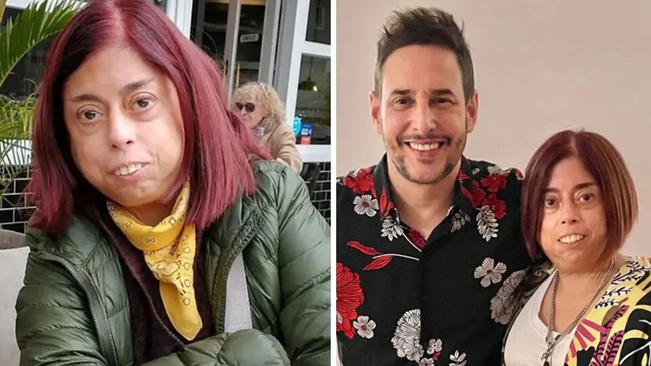 Meche Portillo antes: fotos de cómo lucía y cuál era la enfermedad que tenía