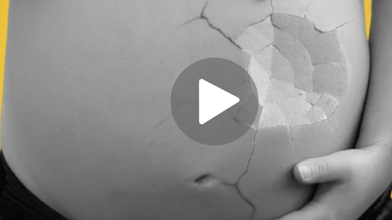 Aborto amarillo video viral: ¿Se puede ver el clip en Twitter o forogore?