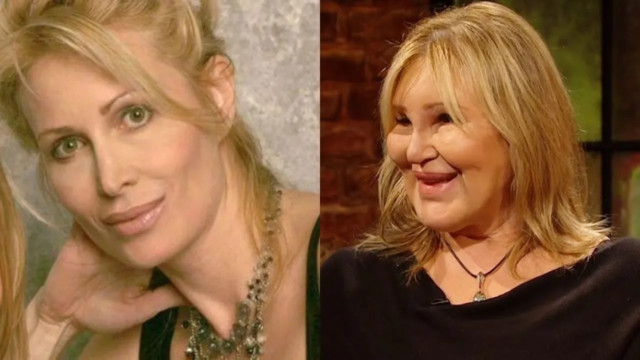 ¿Carol Bryan qué le pasó?: cirugías, quién es, qué hizo, biografía y Wikipedia