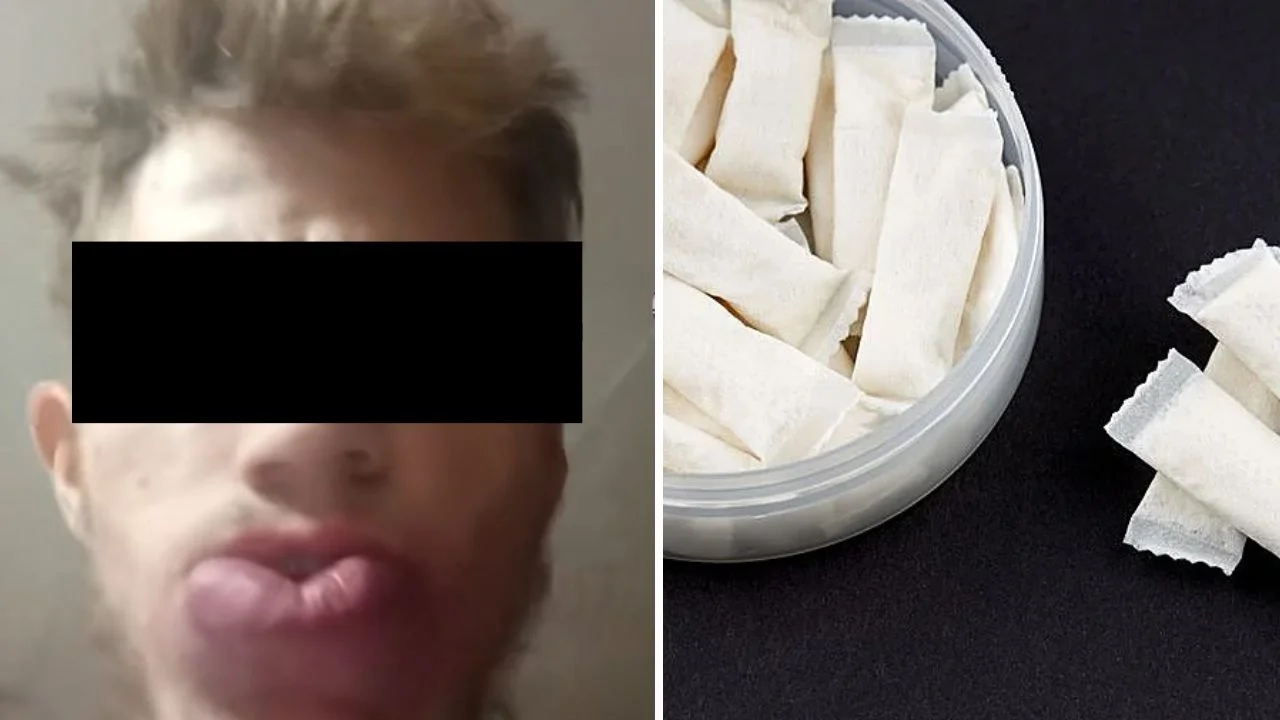 Chico que usaba snus fotos: ¿la historia del joven que se le cayó la boca es real?
