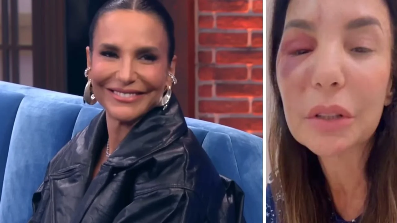 ¿Qué le pasó a Ivete Sangalo? Accidente y estado actual de la cantante